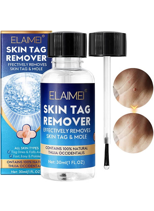 Skin Tag Remover
