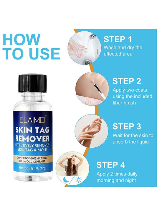 Skin Tag Remover