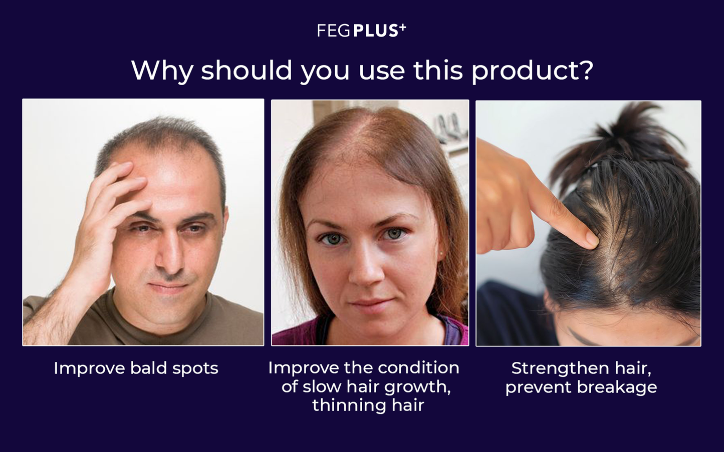 FEG Plus Hair Growth Serum.سيروم نمو الشعر FEG Plus
