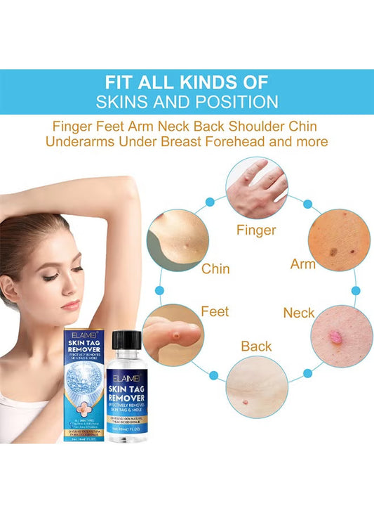 Skin Tag Remover
