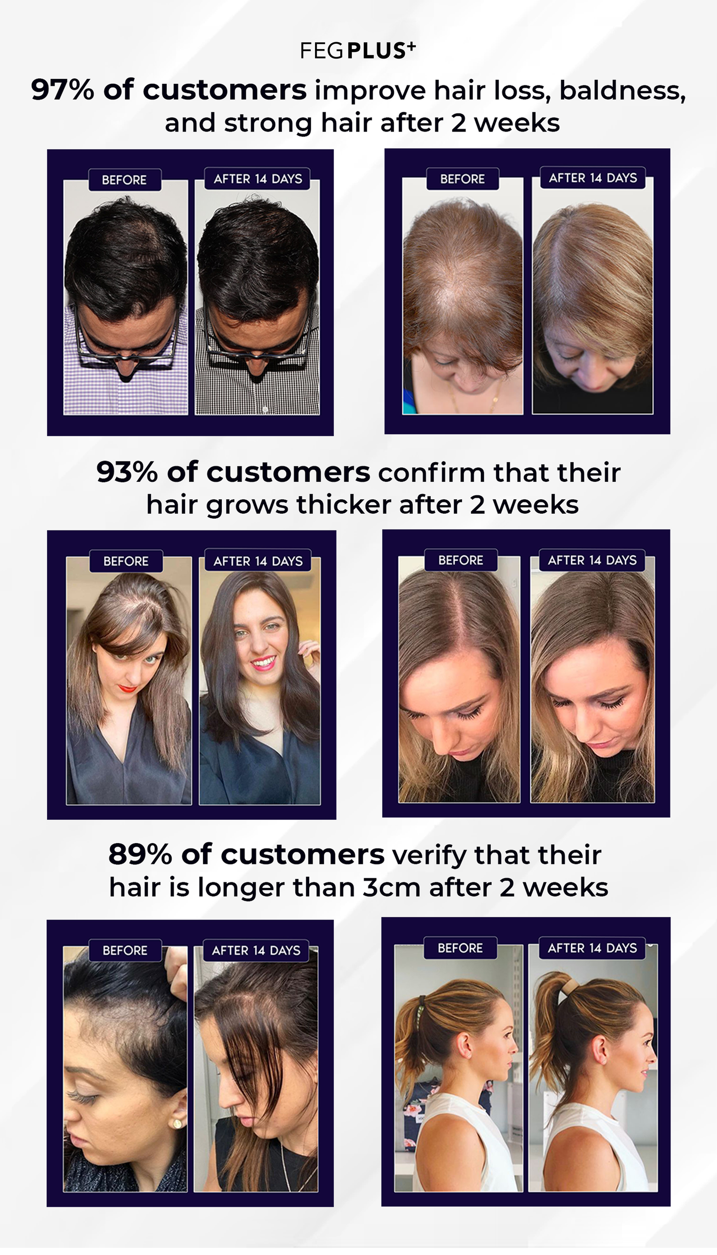 FEG Plus Hair Growth Serum.سيروم نمو الشعر FEG Plus